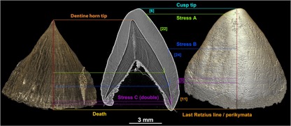 Dental_Development_1.jpg