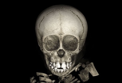 S_D_of_Skull_and_Brain_1.jpg