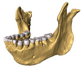 Three-dimensional reconstruction of the new lower jaw