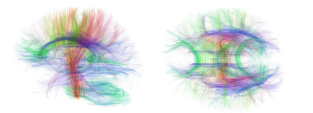nerve-fibers.jpg  
