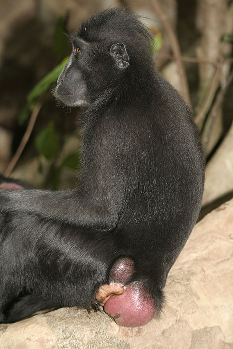 adolescent-female-with-swelling.jpg  